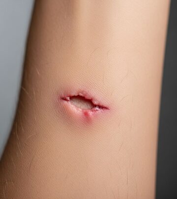 Comprehensive guide to understanding, identifying, and treating human bite wounds and infections.