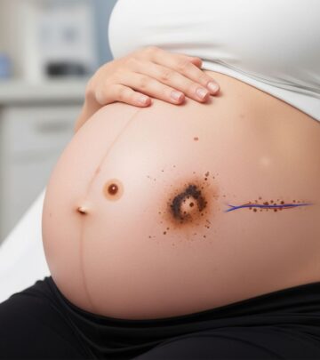 Understanding changes in moles and melanoma risks during pregnancy: diagnosis, management, and outcomes.