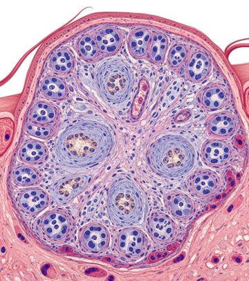 Comprehensive guide to pilomatrix carcinoma: understanding this rare malignant skin tumor.