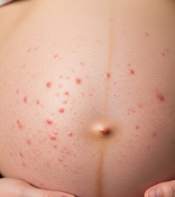 Understanding the itchy rash of late pregnancy: causes, symptoms, diagnosis, and safe treatments for relief.